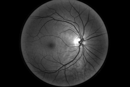 Google’s medical AI was super accurate in a lab